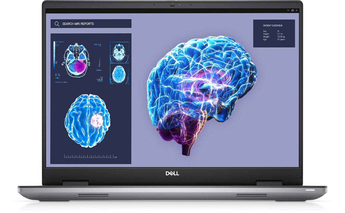 Dell Precision 7680 Mobile Workstation Notebook PC – Core i7-13850HX / 16.0″ FHD+ / 16GB RAM / 512GB SSD / NVIDIA RTX 2000 8G