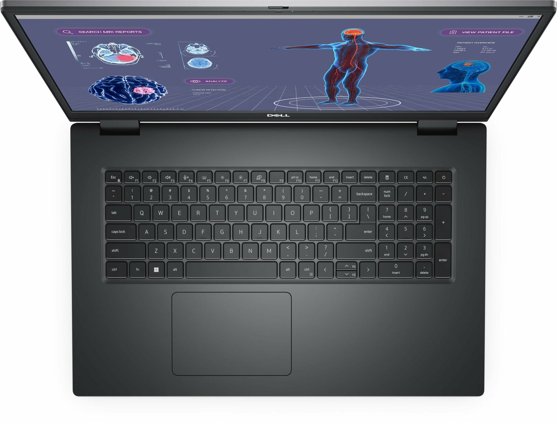 Dell Precision 7780 Mobile Workstation Notebook PC – Core i9-13950HX / 17.0″ FHD / 32GB RAM / 1TB SSD / NVIDIA RTX 3500 Graph